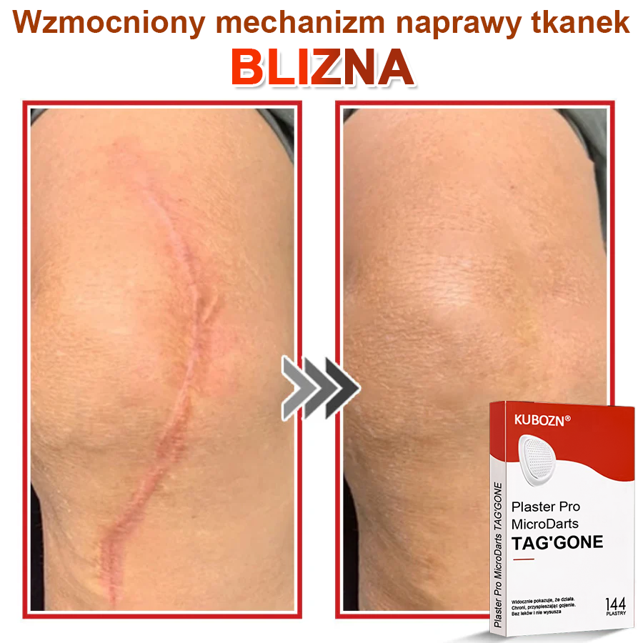 🌈 KUBOZN® mikrotűs botanikai tapasz a bőr szemölcseinek eltávolítására