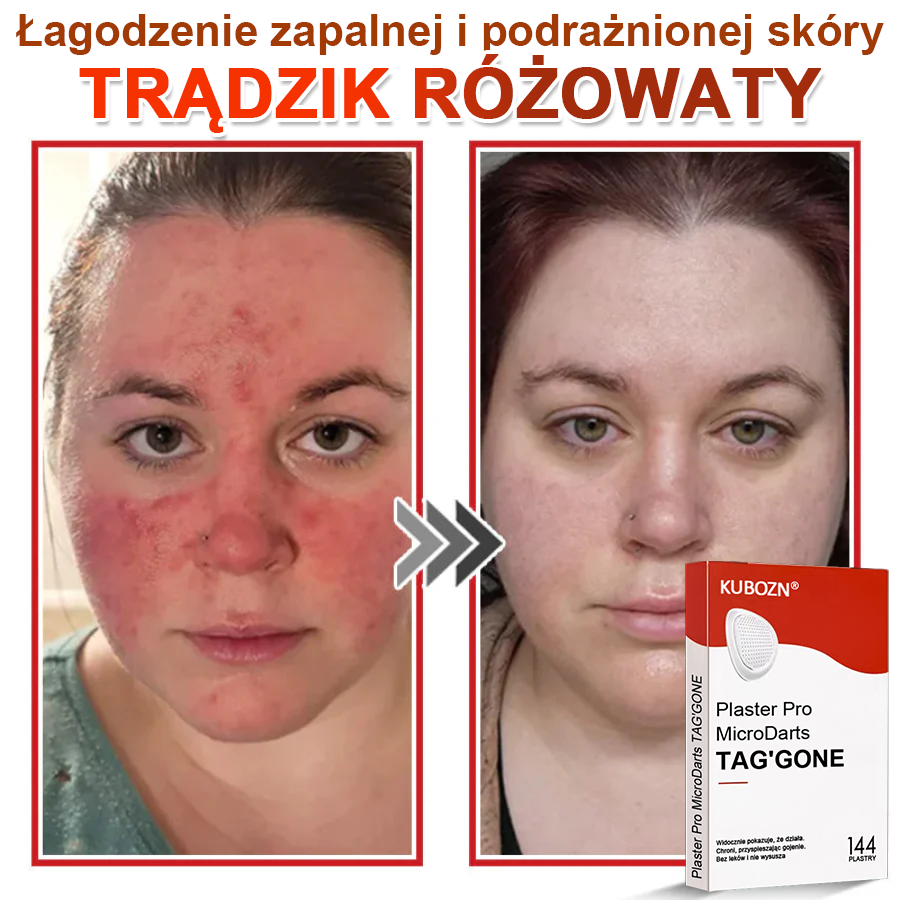 🌈 KUBOZN® mikrotűs botanikai tapasz a bőr szemölcseinek eltávolítására