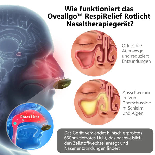 OVEALLGO™ AZONNALI LÉGLEGZŐSÉGI ORRTERÁPIÁS KÉSZÜLÉK VÖRÖS FÉNYEL